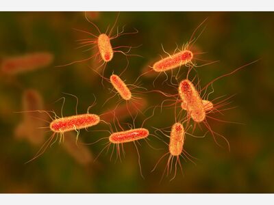 Cluster of Shiga-toxin producing E. coli infections among children in King County ― Unknown source